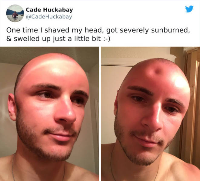 Never Forget Sunscreen!