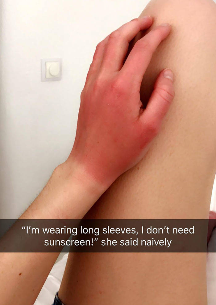 Never Forget Sunscreen!