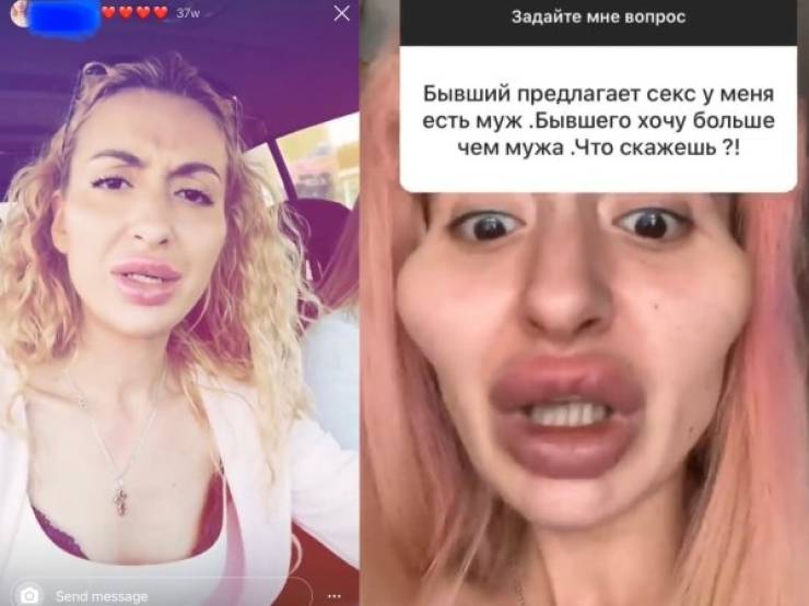 Plastic Surgery Is DEFINITELY Not For Everyone…