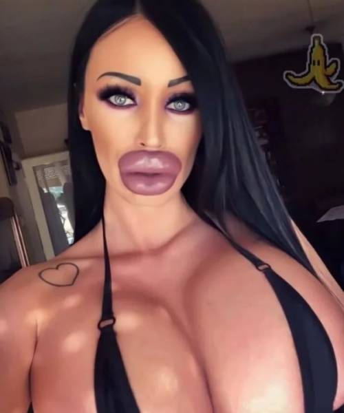 Plastic Surgery Is DEFINITELY Not For Everyone…