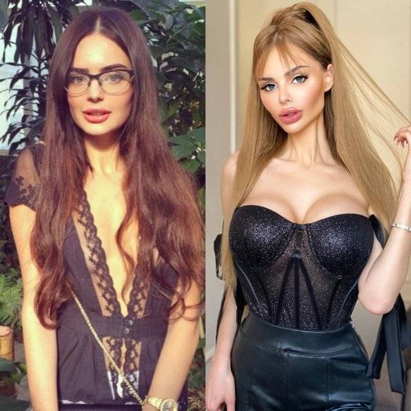 Plastic Surgery Is DEFINITELY Not For Everyone…