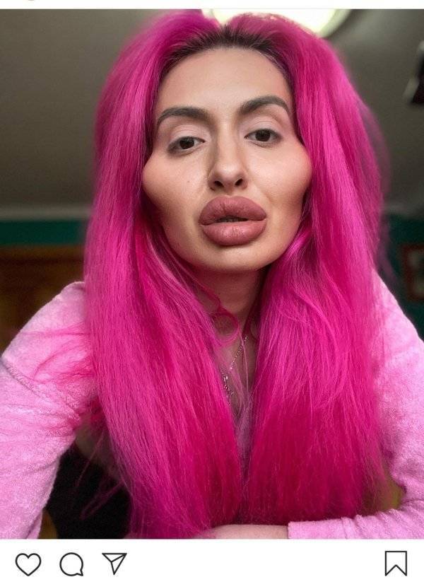 Plastic Surgery Is DEFINITELY Not For Everyone…