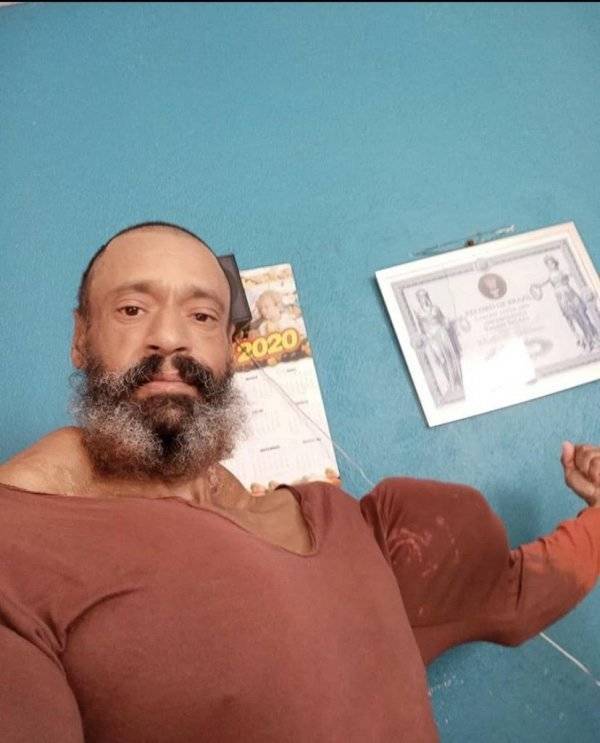 Plastic Surgery Is DEFINITELY Not For Everyone…