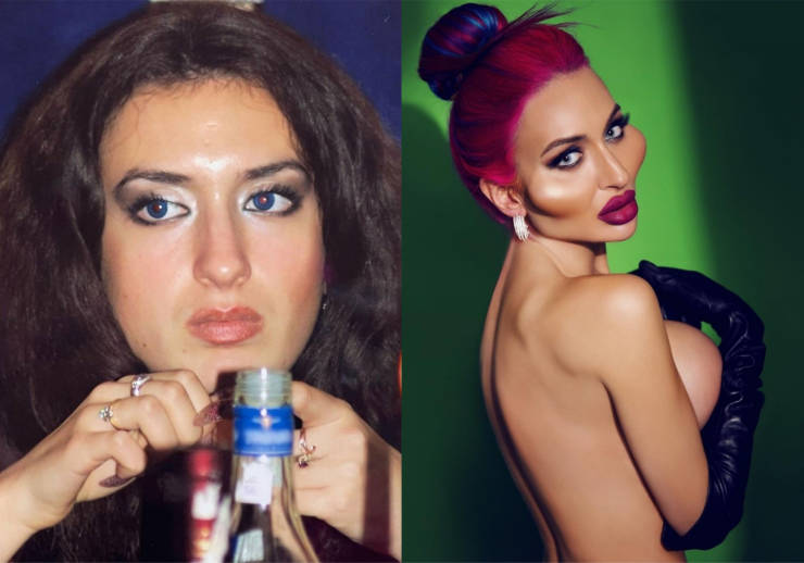 Before And After “Beauty” Fillers…