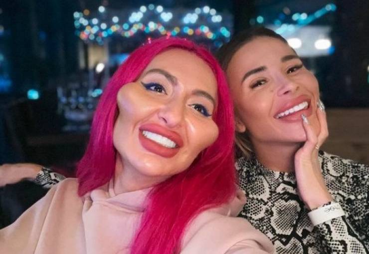 Before And After “Beauty” Fillers…