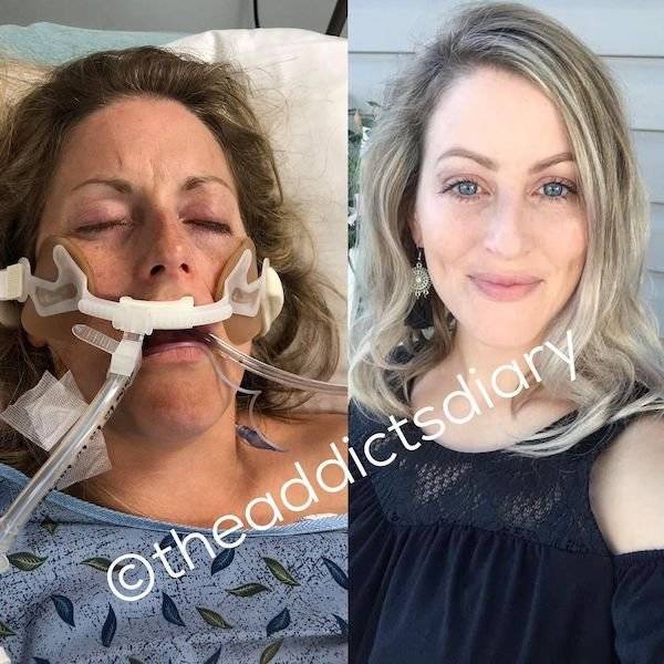 Former Drug Addicts Share Their Inspiring Recovery Stories