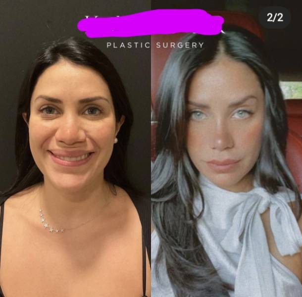 When Photo Editing Is A Curse…