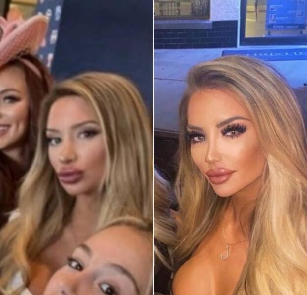 Photo Editing Is Bad For Their Mental Health…