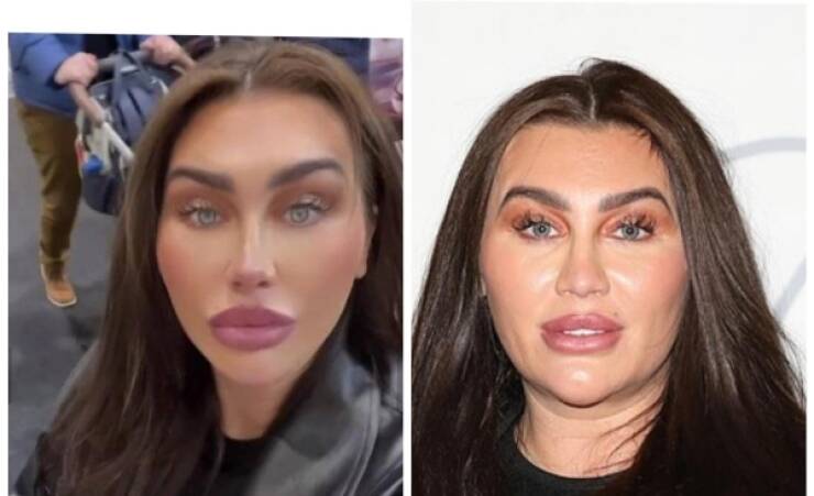 Photo Editing Is Bad For Their Mental Health…