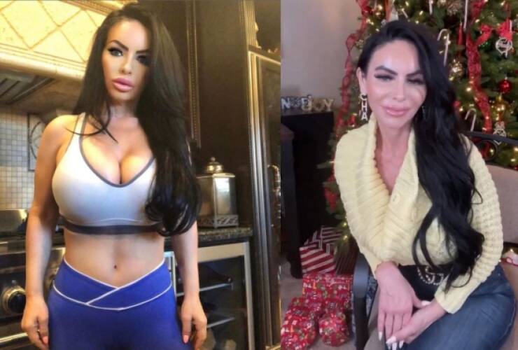 Photo Editing Is Bad For Their Mental Health…