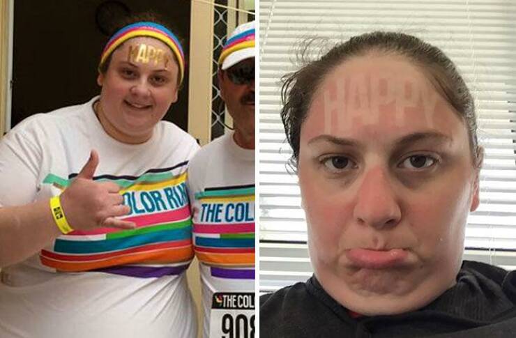 When Sunbathing Goes Wrong…