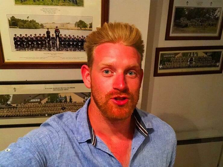 When Sunbathing Goes Wrong…