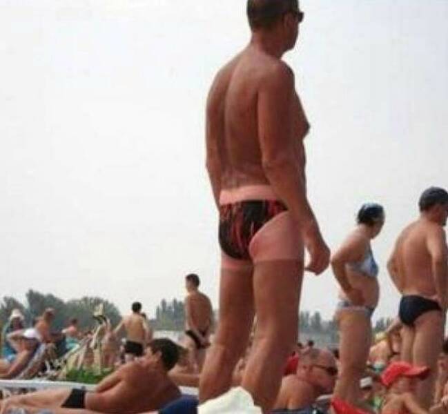 When Sunbathing Goes Wrong…
