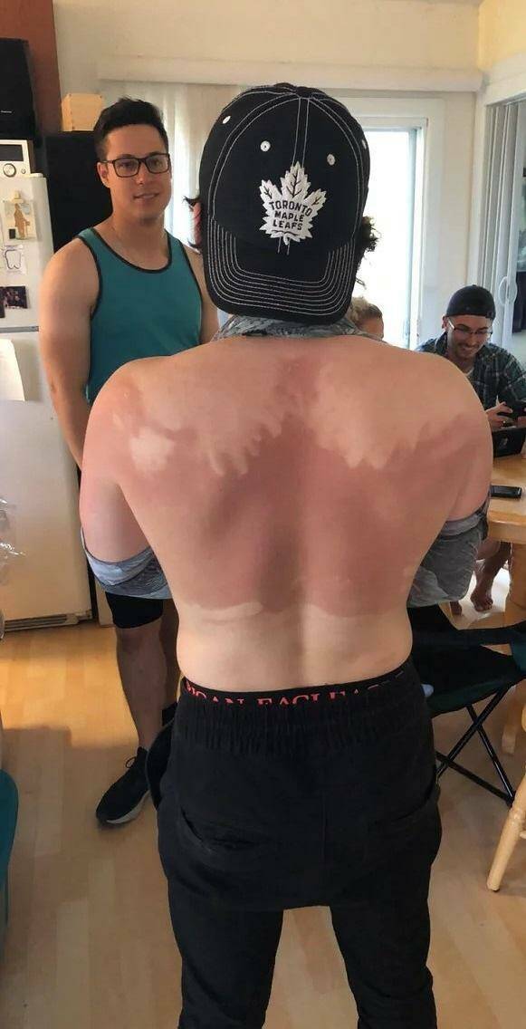 When Sunbathing Goes Wrong…