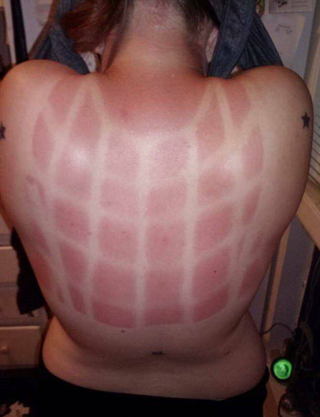 When Sunbathing Goes Wrong…
