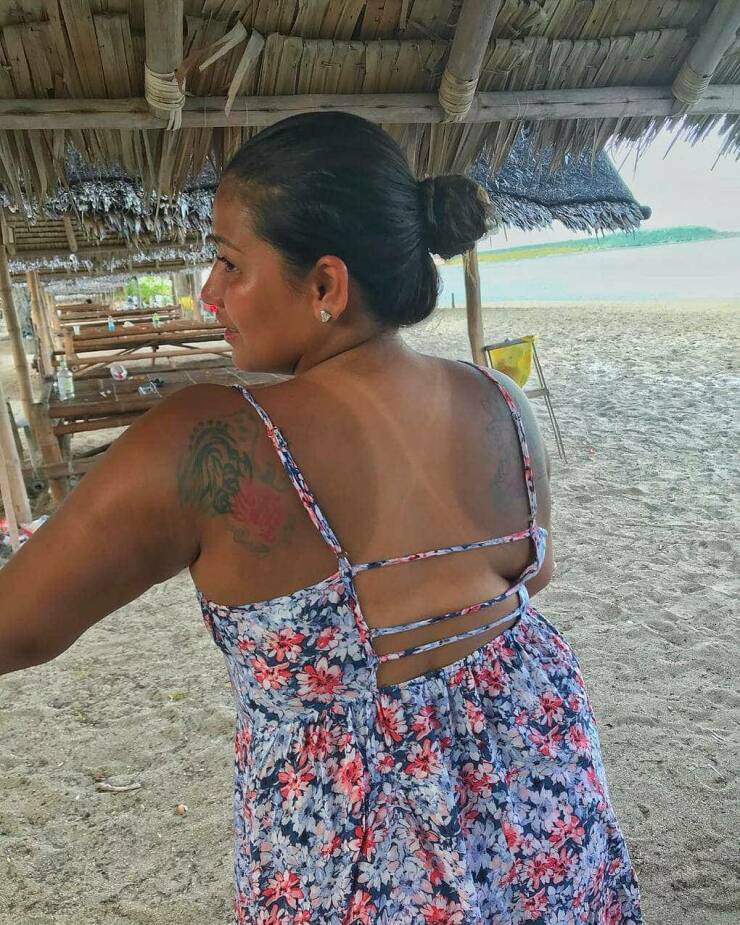 When Sunbathing Goes Wrong…