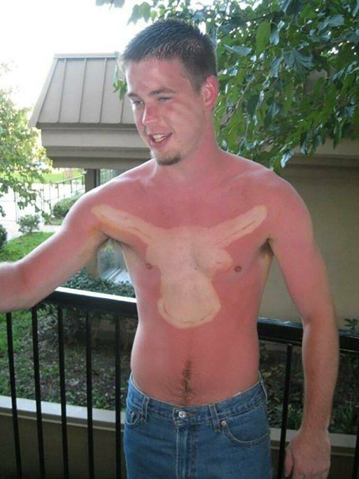 When Sunbathing Goes Wrong…