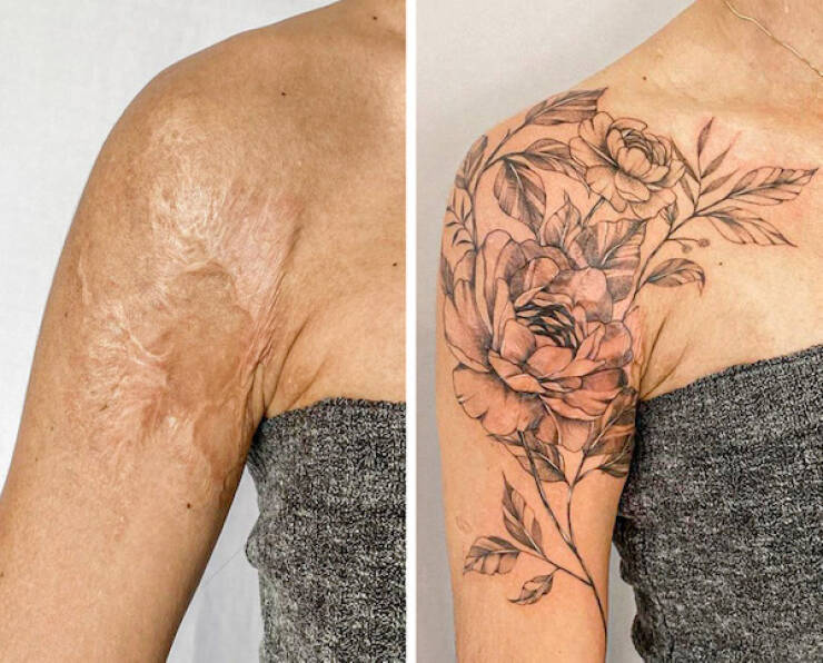 People Covering Their Scars In Cool Fashion