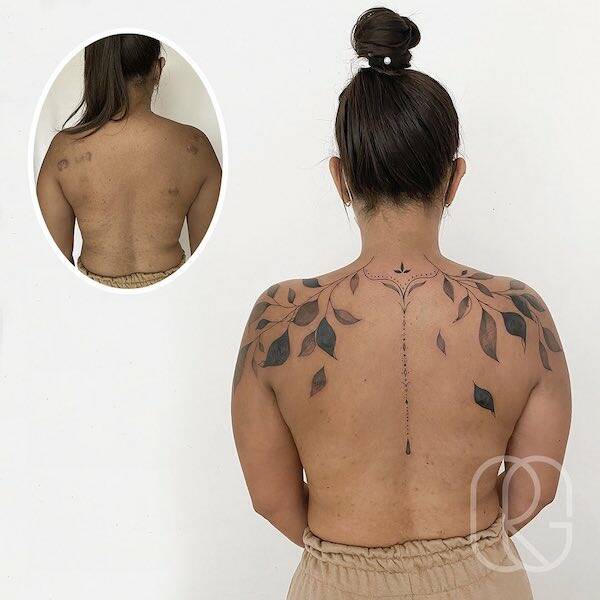 People Covering Their Scars In Cool Fashion