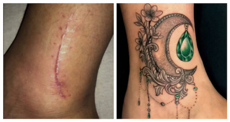 People Covering Their Scars In Cool Fashion