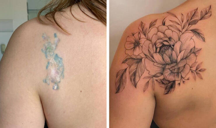 People Covering Their Scars In Cool Fashion