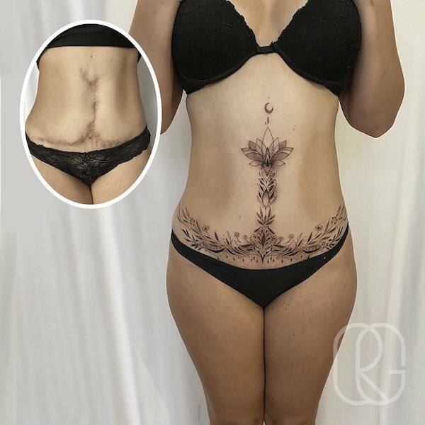 People Covering Their Scars In Cool Fashion