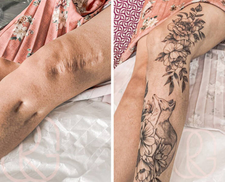 People Covering Their Scars In Cool Fashion