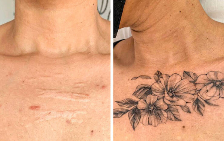 People Covering Their Scars In Cool Fashion