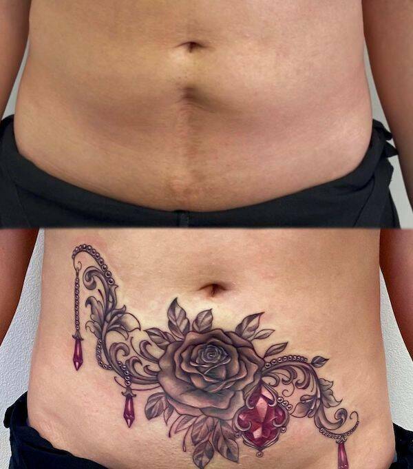 People Covering Their Scars In Cool Fashion