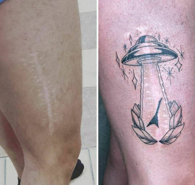 Tattoo Artists Covering Scars And Birthmarks