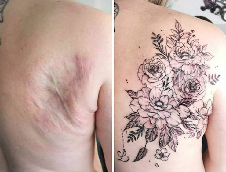 Tattoo Artists Covering Scars And Birthmarks
