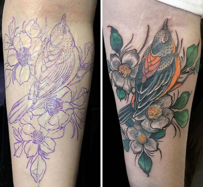 Tattoo Artists Covering Scars And Birthmarks