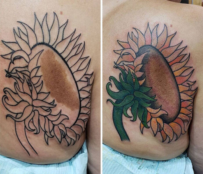 Tattoo Artists Covering Scars And Birthmarks