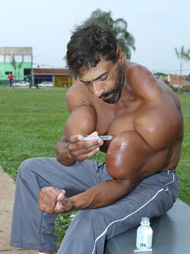 Synthol Does NOT Look Good, Guys…