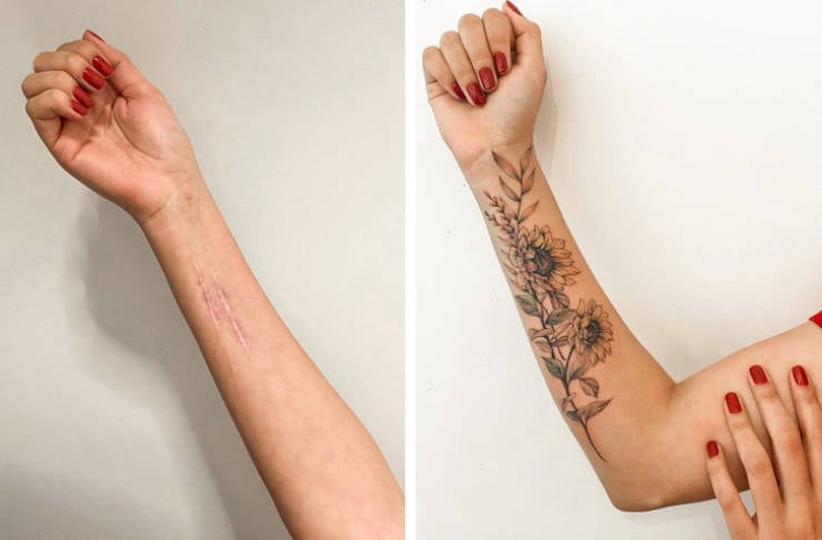 Artist Saves People’s Scars By Tattooing Over Them