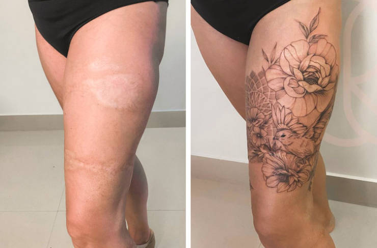 Artist Saves People’s Scars By Tattooing Over Them