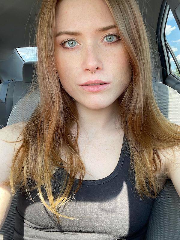 the charm of freckled faces 53 pics 2.html - 53 HD Photos | Premium Gallery 2023