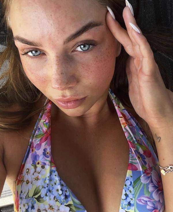 the charm of freckled faces 53 pics 2.html - 53 HD Photos | Premium Gallery 2023