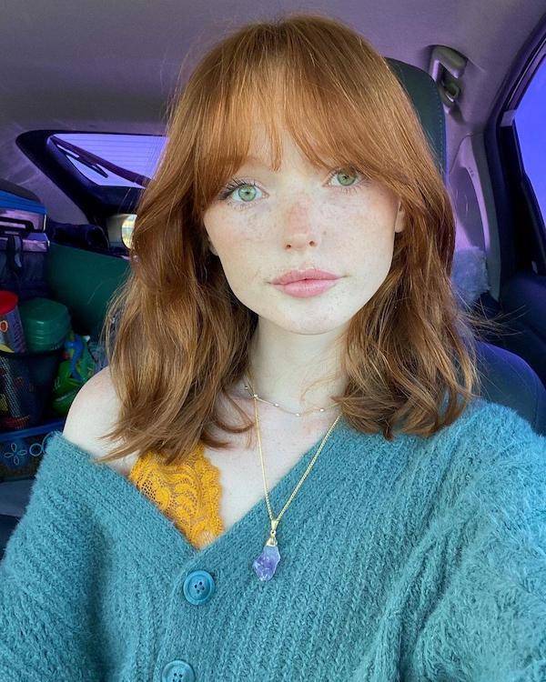 the charm of freckled faces 53 pics 2.html - 53 HD Photos | Premium Gallery 2023