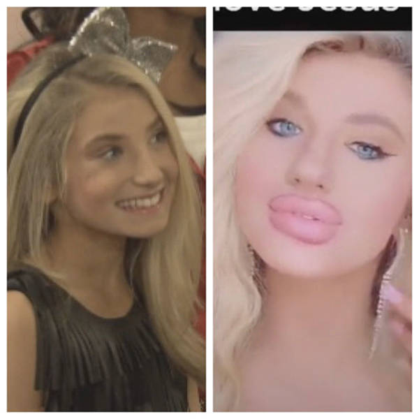 When Plastic Surgery Goes Too Far