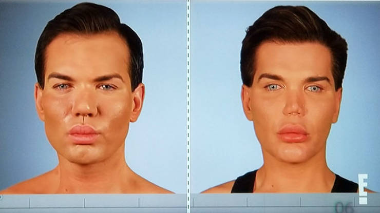 When Plastic Surgery Goes Too Far