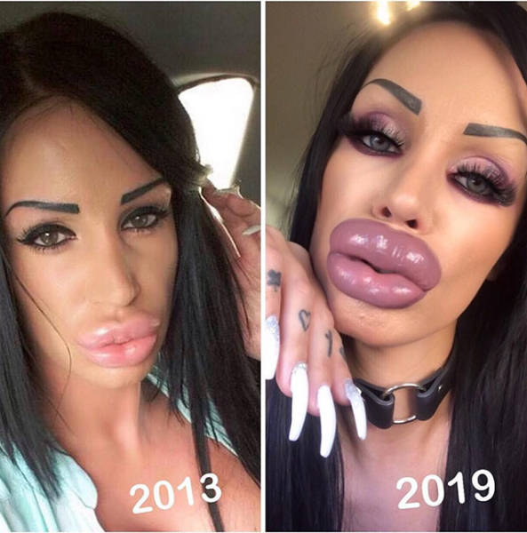 When Plastic Surgery Goes Too Far