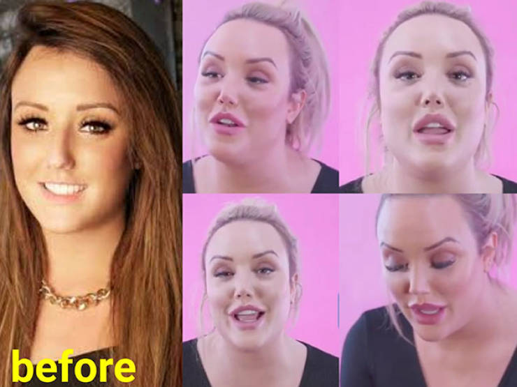 When Plastic Surgery Goes Too Far