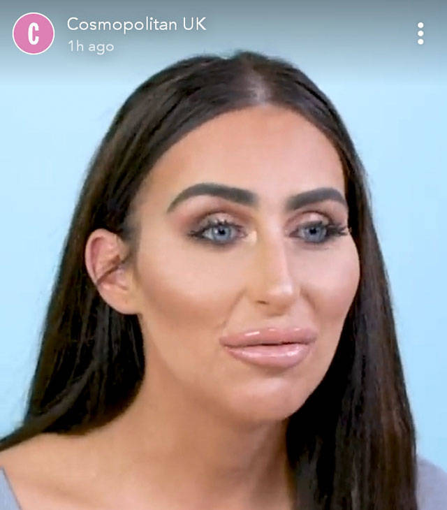 When Plastic Surgery Goes Too Far