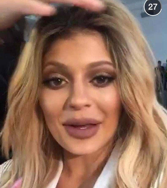 When Plastic Surgery Goes Too Far