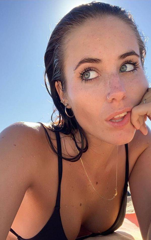 the charm of freckled faces 33 pics 6.html - 33 HD Photos | Premium Gallery 2023