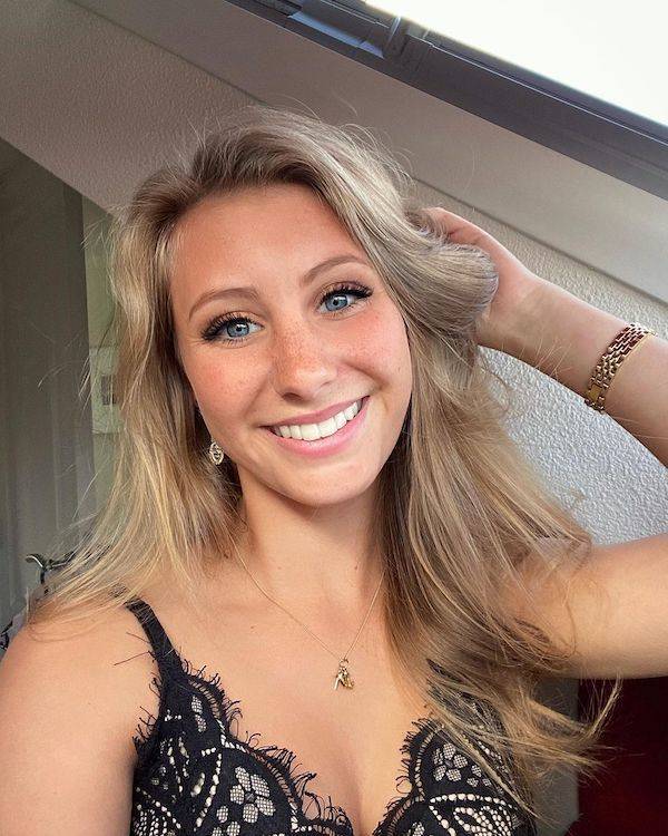 the charm of freckled faces 33 pics 6.html - 33 HD Photos | Premium Gallery 2023