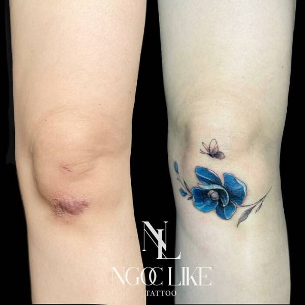 tattoo artists amazing skill in concealing scars with art 39 pics 18.html - 39 HD Photos | Premium Gallery 2023