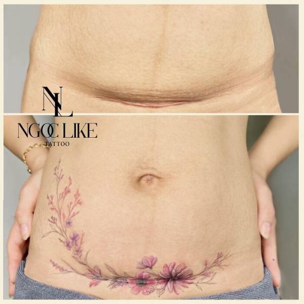 tattoo artists amazing skill in concealing scars with art 39 pics 18.html - 39 HD Photos | Premium Gallery 2023