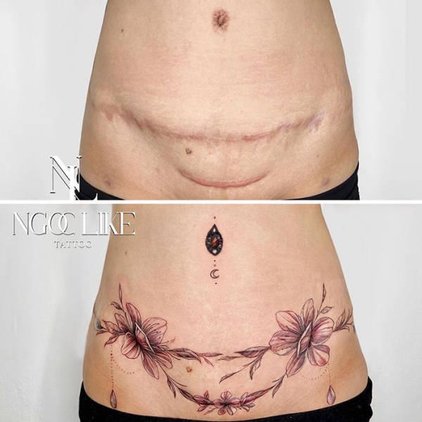 tattoo artists amazing skill in concealing scars with art 39 pics 18.html - 39 HD Photos | Premium Gallery 2023